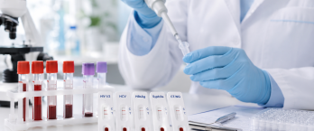  NVSC kviečia pasitikrinti dėl ŽIV, LPI ir virusinių hepatitų
